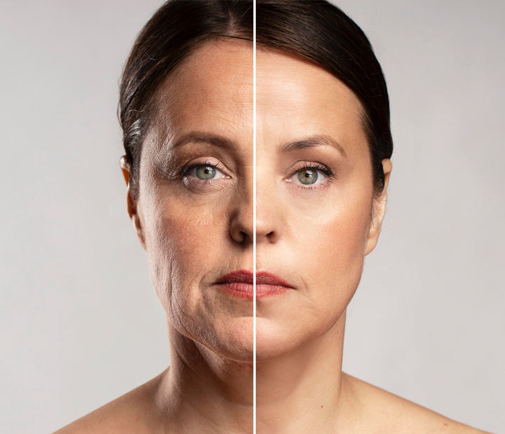 Tratamientos de Rejuvenecimiento